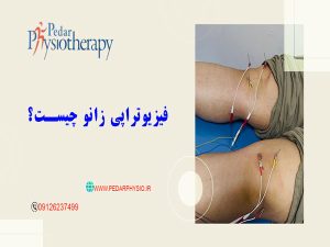 What is knee physiotherapy?